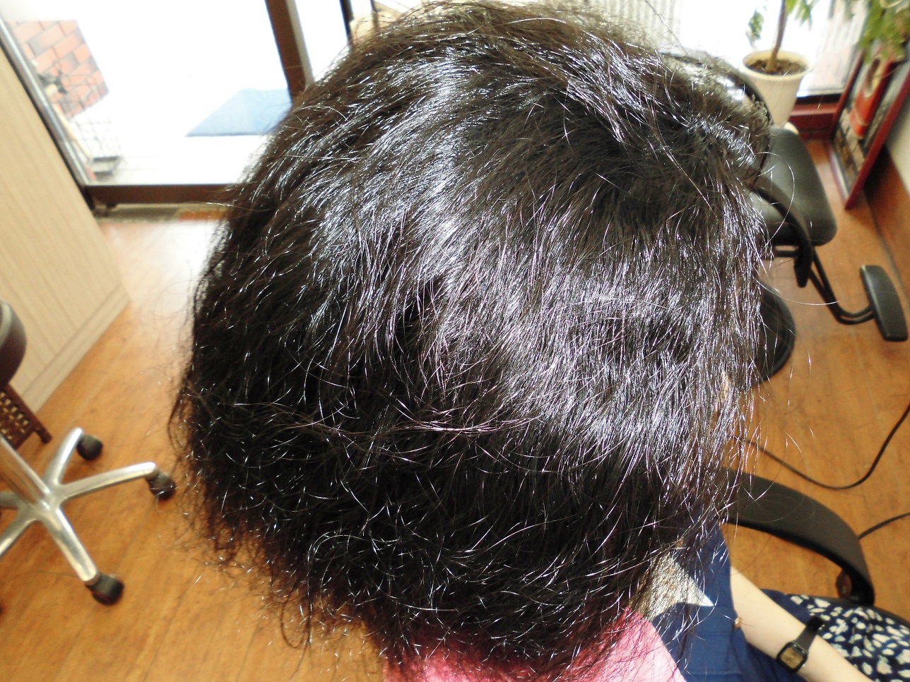 beforeモデル写真