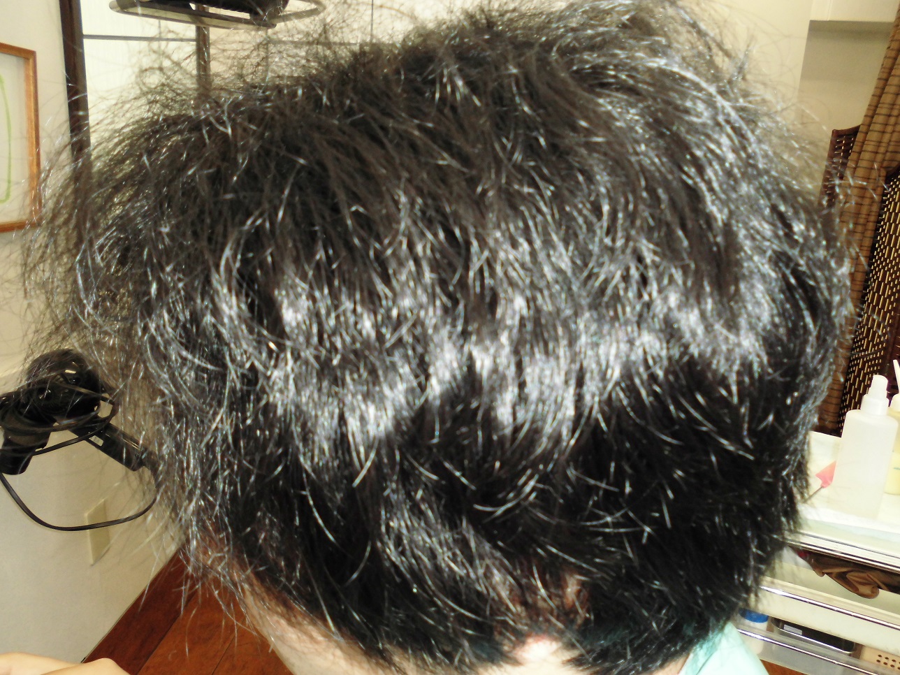 beforeモデル写真