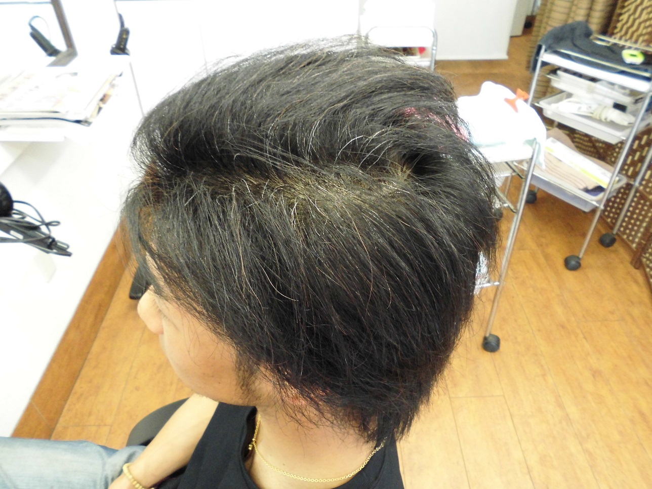 beforeモデル写真