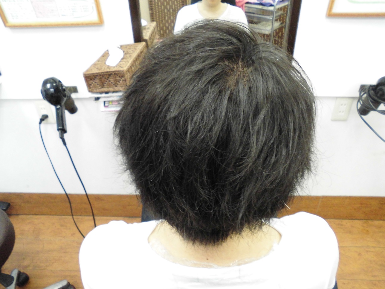beforeモデル写真