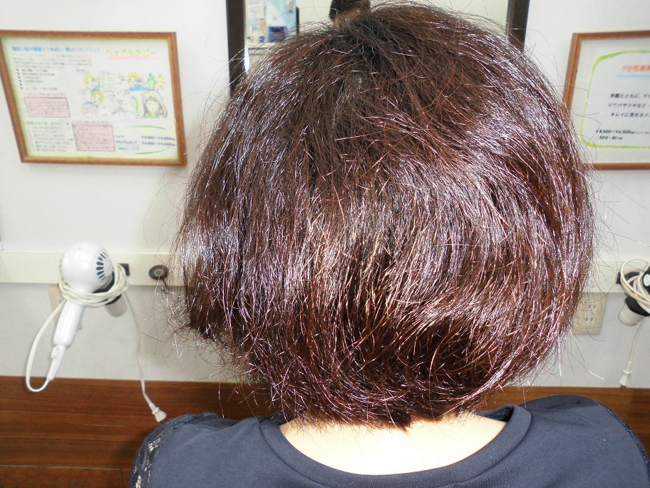 beforeモデル写真